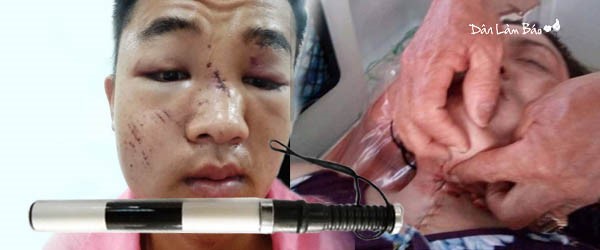 hình Người lao động A